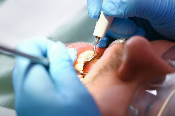 Best Emergency Root Canal Treatment in Presidio, TX